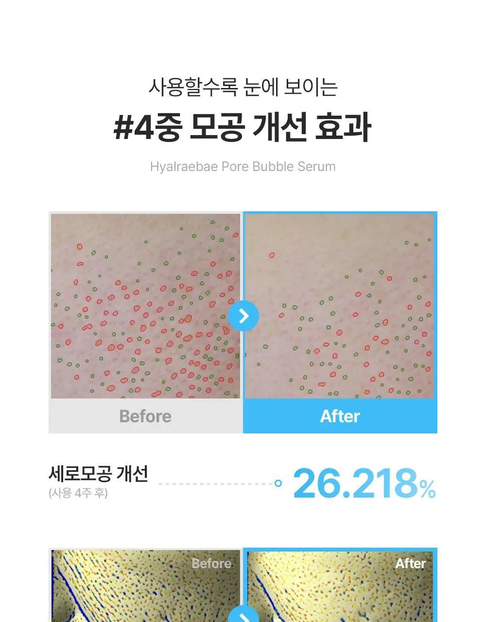 [품절대란/수부지 화잘먹 세럼] 믹순 히알레배 포어 버블 세럼 70ml 상세페이지 25